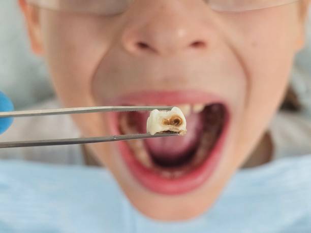 Best Cosmetic Emergency Dentistry in Weaver, AL