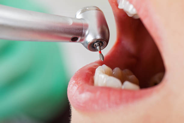 Best Urgent Care for Lost Fillings or Crowns in Weaver, AL